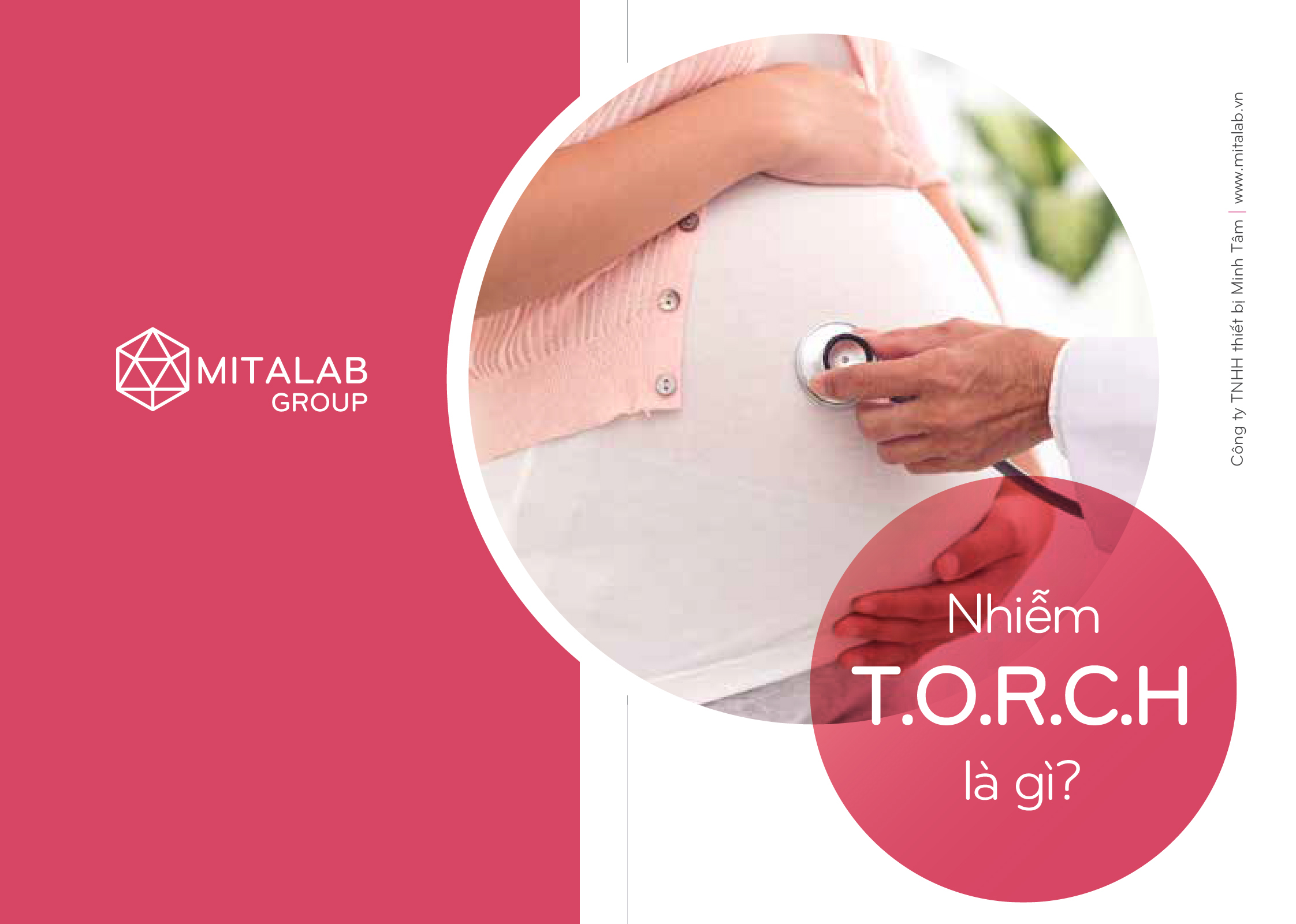 TORCH – NGUY HIỂM CHO THAI NHI HOẶC GÂY TAI BIẾN SẢN KHOA