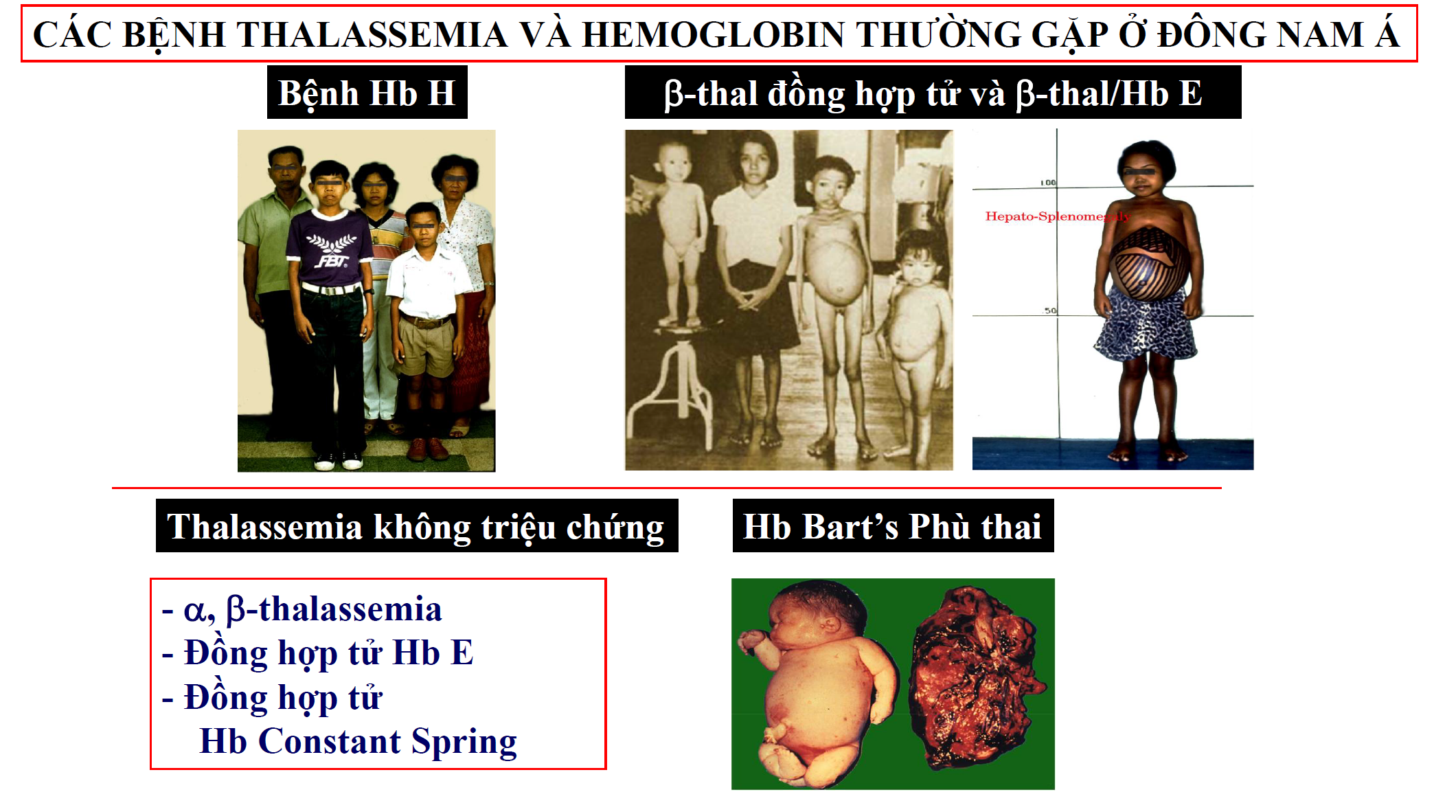 ĐỪNG ĐỂ THALASSEMIA ĐE DỌA TỚI GIỐNG NÒI